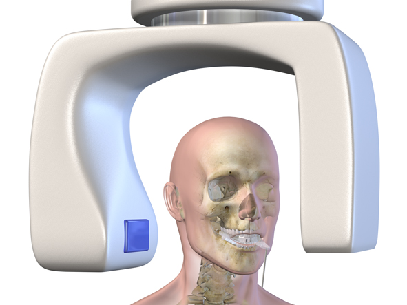 DVT Comptertomographie Dr. Fangmann